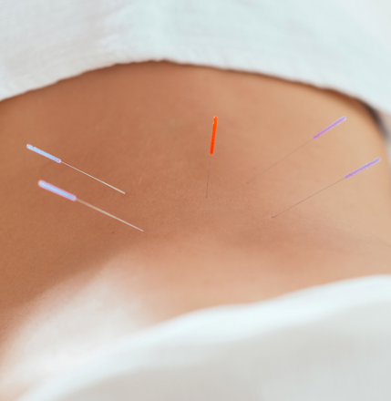evidence based acupuncture